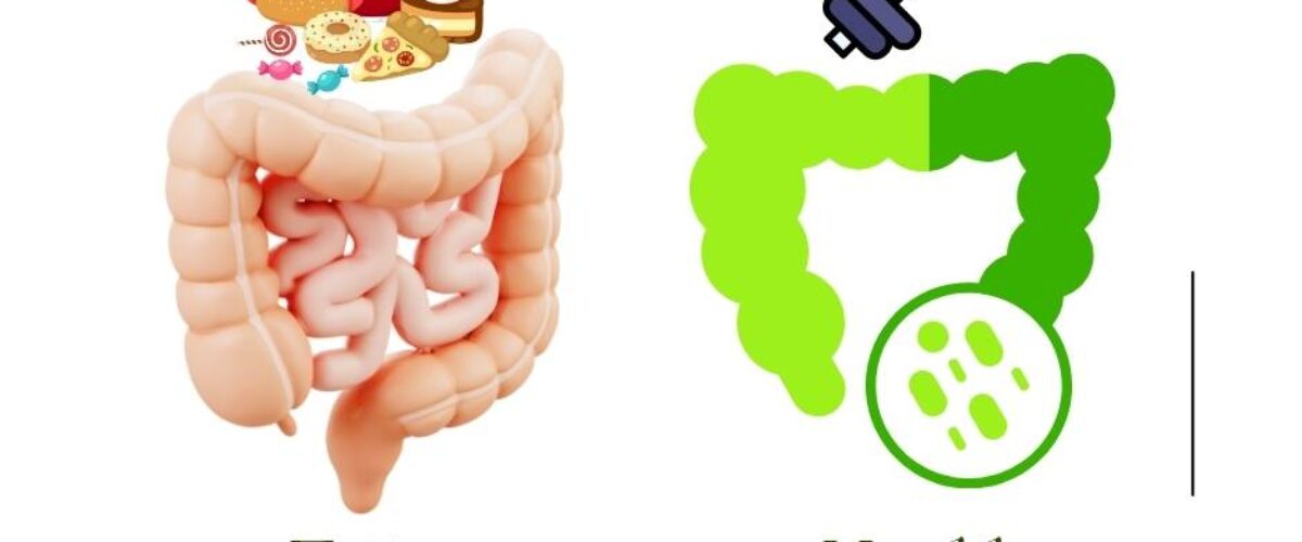 Illustration comparing a fatty, unhealthy gut filled with junk food to a lean, healthy gut with exercise and good bacteria.